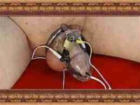 Video Estim electro